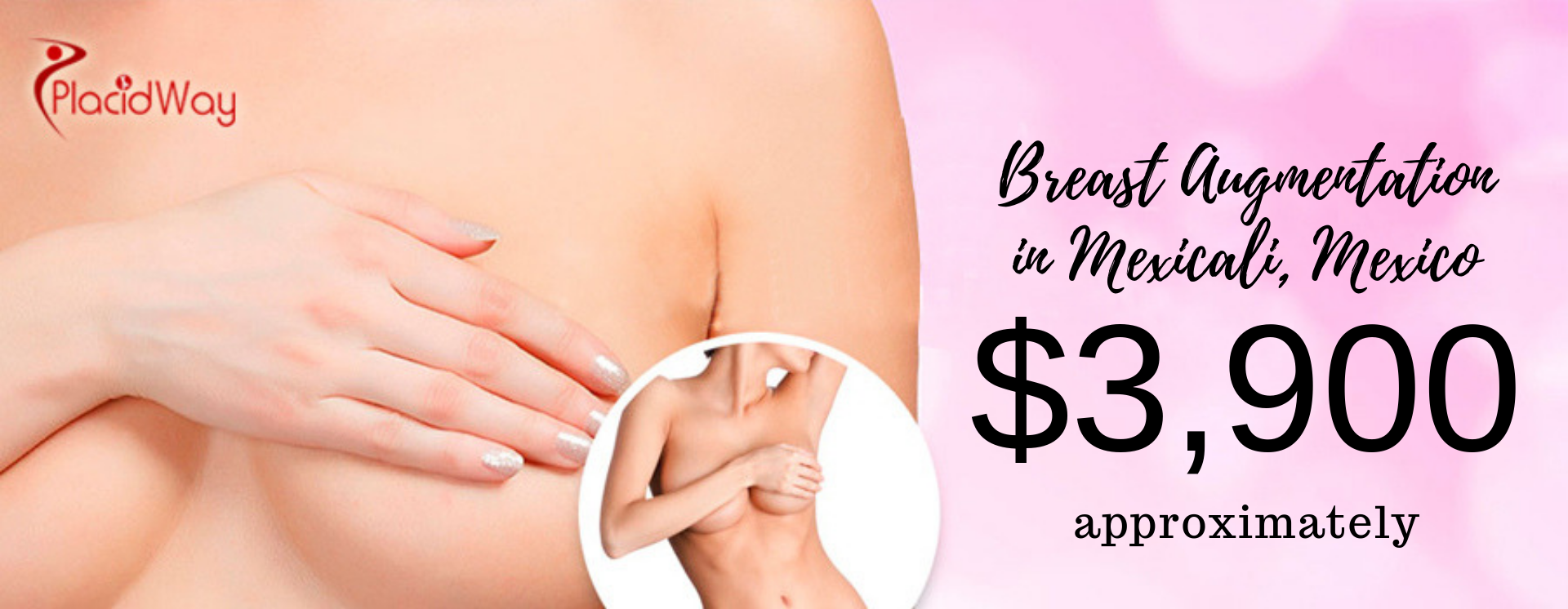 cost of breast augmentation treatment in Mexicali